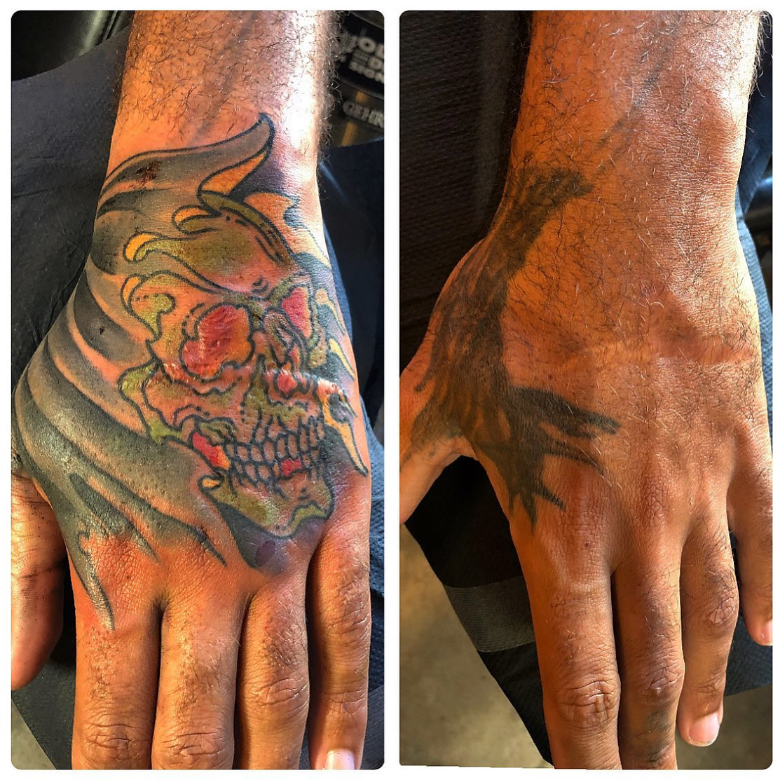 best cover up tattoo artist in dallas