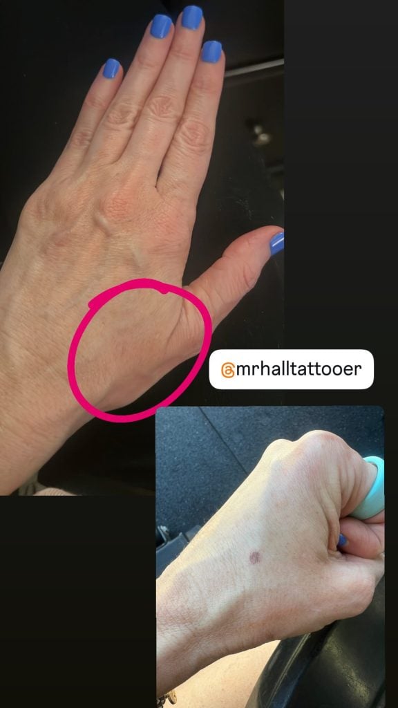 Fine Line Reduction Services | Lamar Street Tattoo Club 09D1A6E4 8EE9 4199 ACA6 66C4E90ECBE3 - May 15, 2025 - - https://lamarstreettattooclub.com/services/laser-services/fine-line-reduction-services/