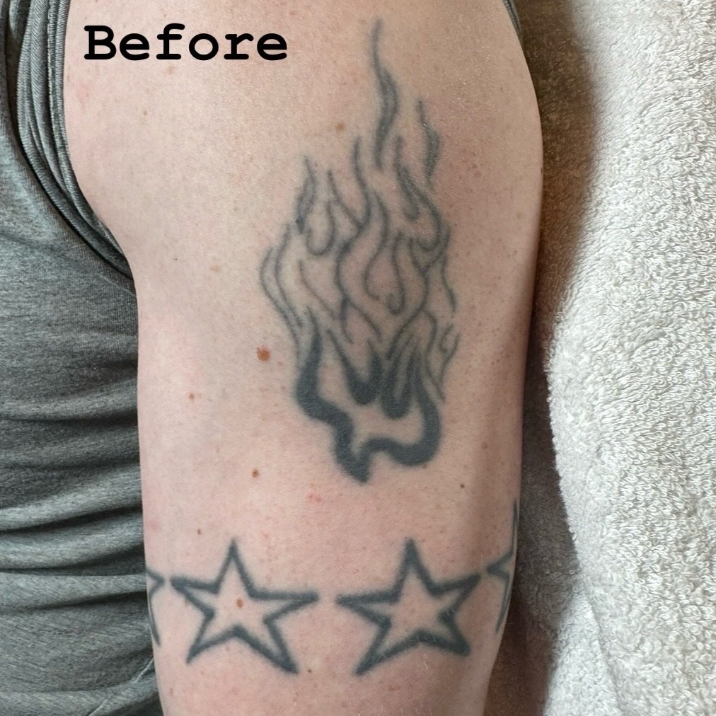 Tattoo Cover-Up Services | Lamar Street Tattoo Club 5854A16E D153 4583 85A7 E15D00BC8E72 - May 30, 2024 - Tattoo Cover-Up Services - https://lamarstreettattooclub.com/services/tattoo-cover-up-services/