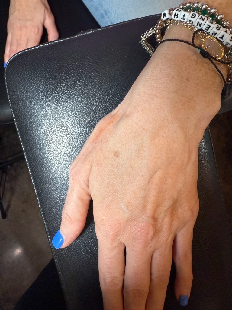 Fine Line Reduction Services | Lamar Street Tattoo Club IMG 0822 - May 15, 2025 - - https://lamarstreettattooclub.com/services/laser-services/fine-line-reduction-services/
